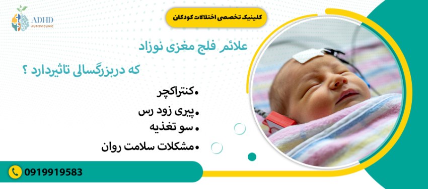 علائم فلج مغزی نوزاد،که دربزرگسالی تاثیردارد ؟